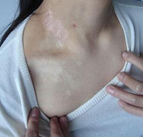 6947dacaeb23e6a1.jpg